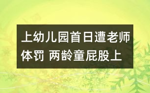 上幼兒園首日遭老師體罰 兩齡童屁股上大面積淤斑