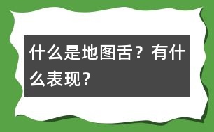 什么是地圖舌？有什么表現(xiàn)？