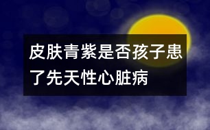 皮膚青紫是否孩子患了先天性心臟病