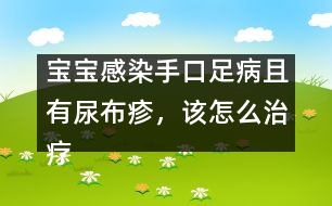 寶寶感染手口足病且有尿布疹，該怎么治療