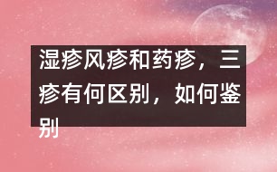 濕疹風(fēng)疹和藥疹，三疹有何區(qū)別，如何鑒別