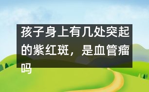 孩子身上有幾處突起的紫紅斑，是血管瘤嗎