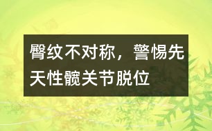 臀紋不對稱，警惕先天性髖關節(jié)脫位