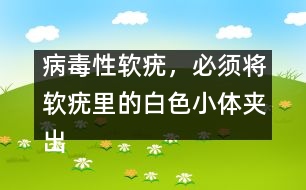 病毒性軟疣，必須將軟疣里的白色小體夾出