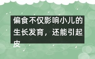 偏食不僅影響小兒的生長(zhǎng)發(fā)育，還能引起皮膚病