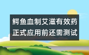 鱷魚血制艾滋有效藥正式應(yīng)用前還需測(cè)試